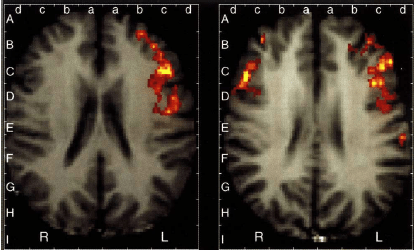 完成语言相关任务时男性女性激活脑区fMRI扫描图